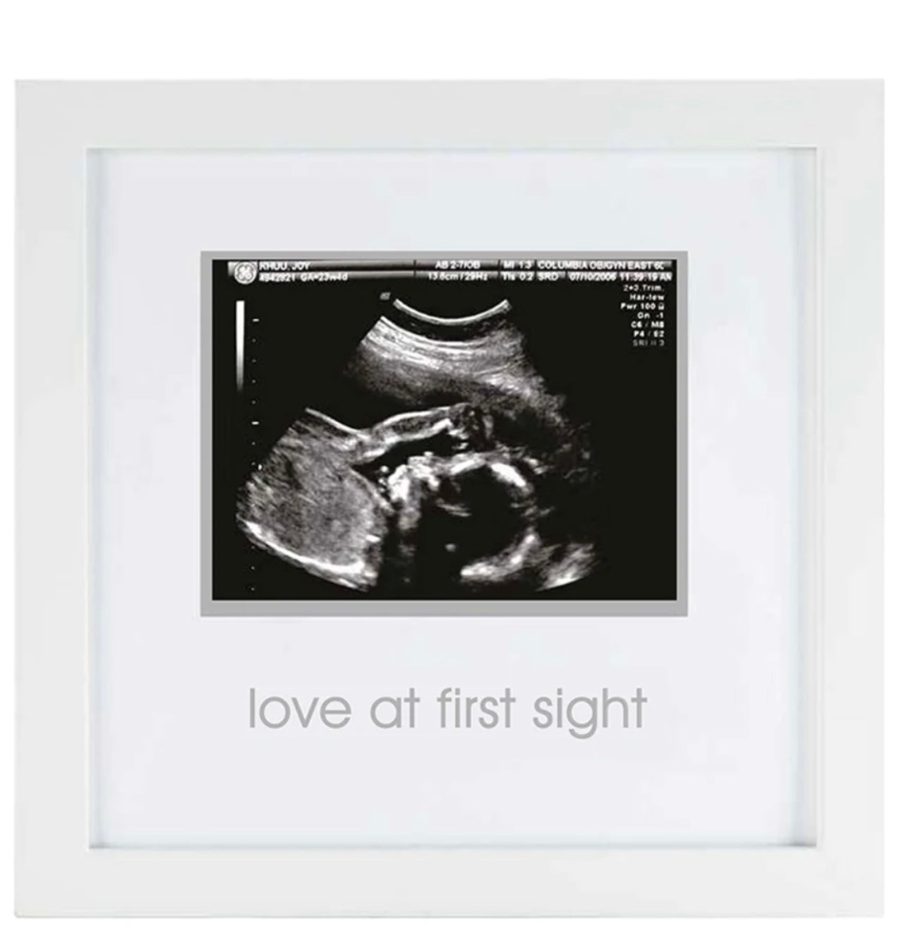 Sonogram Frame-520 Baby & Kids Gifts-Simply Stylish Boutique-Simply Stylish Boutique | Women’s & Kid’s Fashion | Paducah, KY